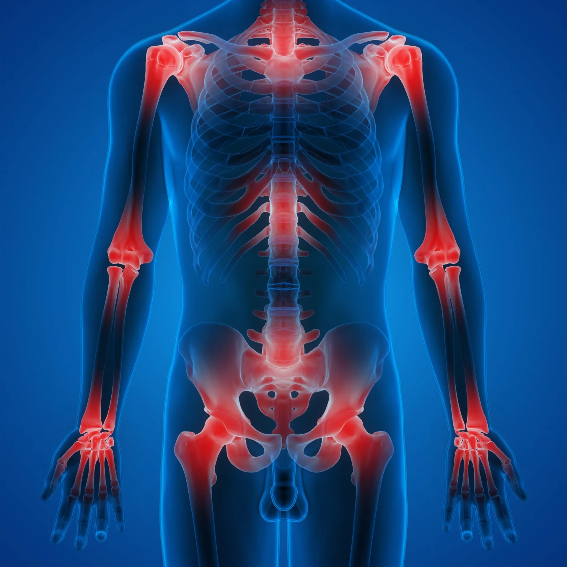 Metabolic Inflammation
