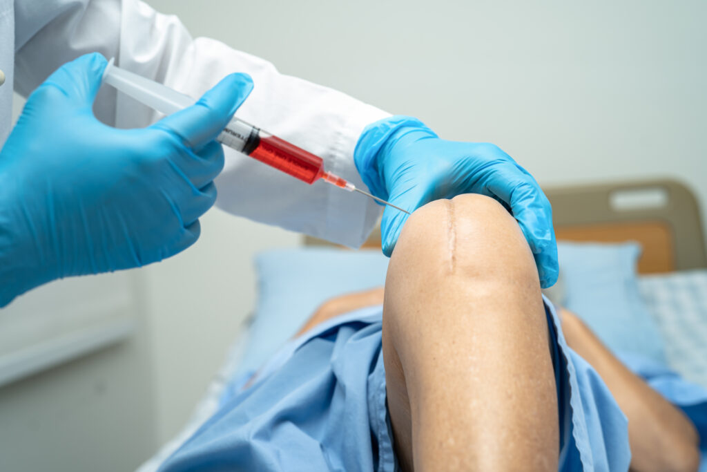 PRP Injections for Joint Repair